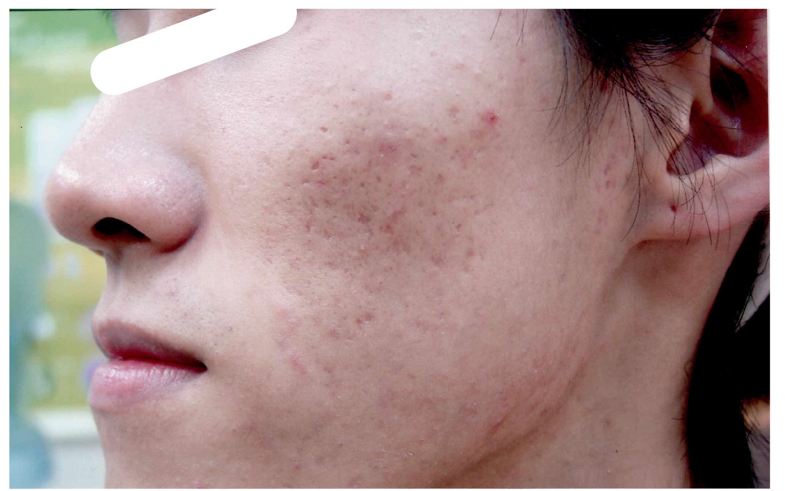 A&B肌斷食美容法 課程體驗照片4