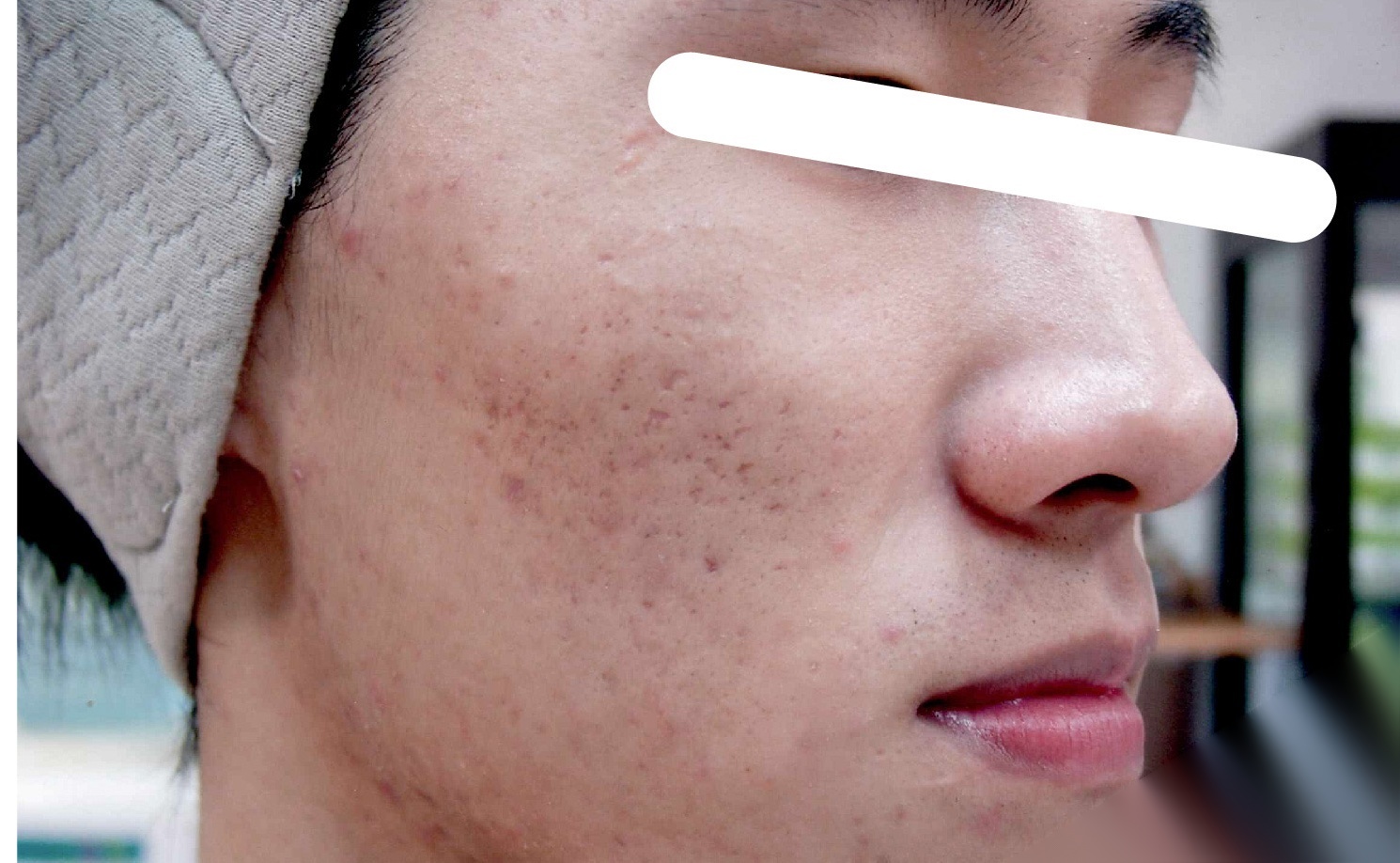 A&B肌斷食美容法 課程體驗照片6